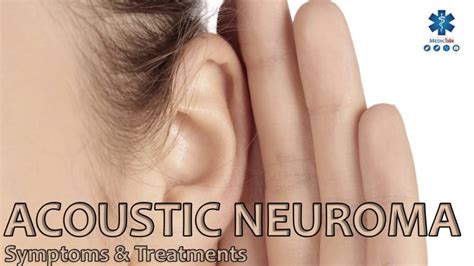 Acoustic Neuroma - Symptoms, Causes And Other Risk Factors