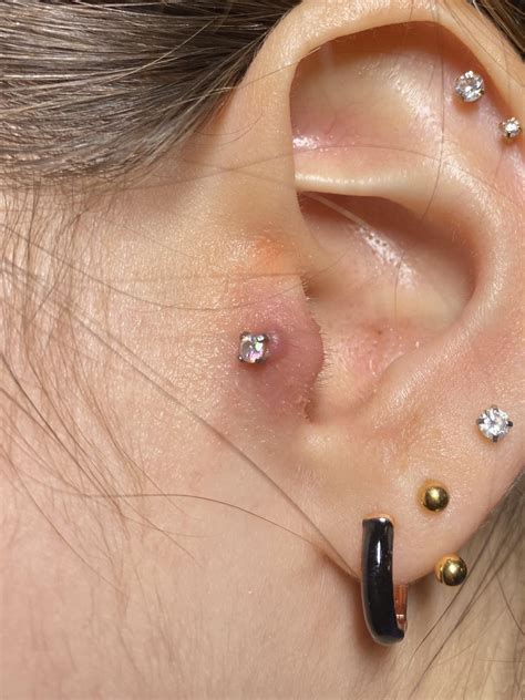 Keloid help : r/piercing