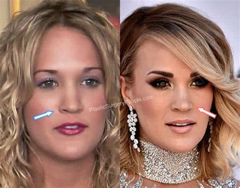 Carrie Underwood: BEFORE and AFTER