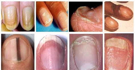 What do different colored fingernails mean – The Meaning Of Color