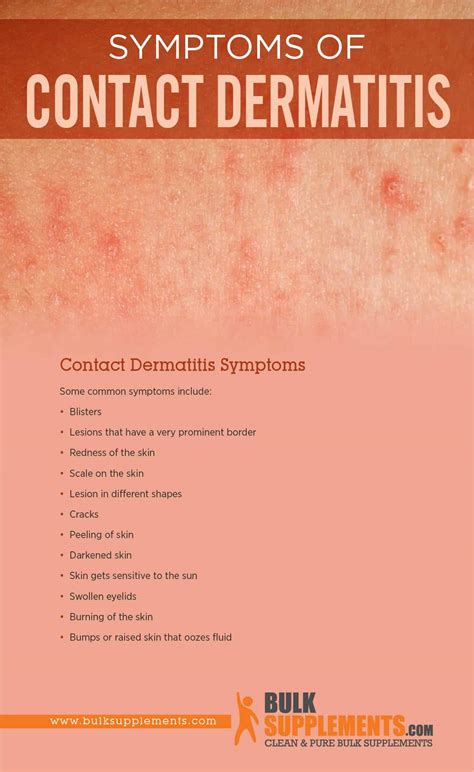 Tablo | Read 'Contact Dermatitis: Symptoms, Causes & Treatment' by