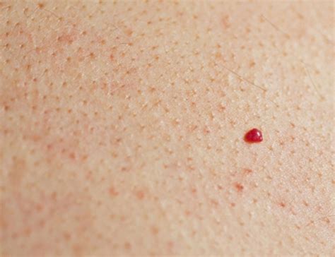 Pinpoint red dots on skin causes - tdfreeloads