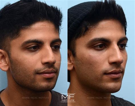 Masculine Face Contouring