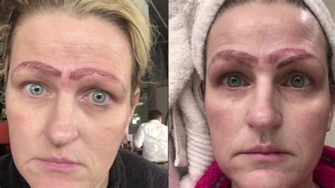 Woman’s Botched Microblading Left Her With Four Weird Eyebrows ...