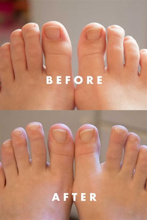 Multi-Purpose-Nail-Repair-Before-After - Allyn Lewis