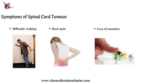 Spinal Cord Tumor Treatment In Chennai | Spine Specialist in India