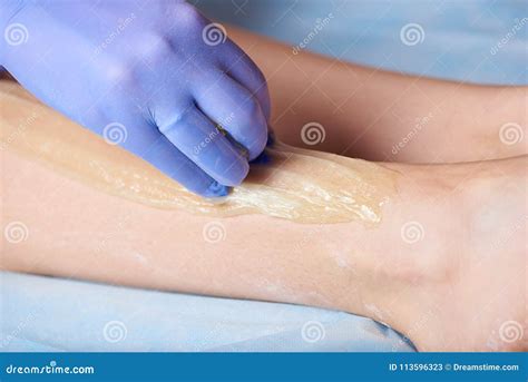 Hair Removal Method Sugaring Stock Image - Image of glove, clean: 113596323