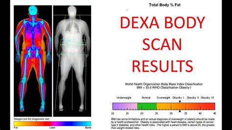 DEXA SCAN full Body Scan results 3 month update have i lost body fat? - YouTube