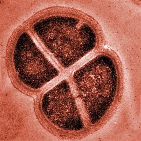 Deinococcus radiodurans - Alchetron, the free social encyclopedia