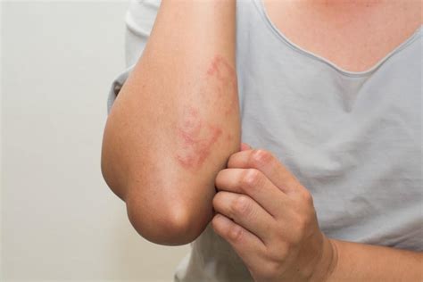 Signs You Should Ask Your Doctor About a Rash: Seacoast Dermatology ...