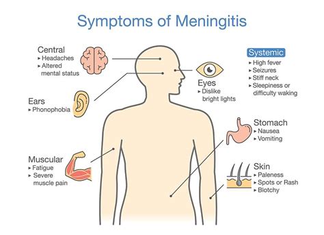 Meningitis Symptoms; 11 Most Important Signs & Symptoms