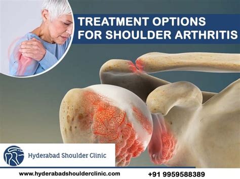 Treatment Options For Shoulder Arthritis - shoulder clinic Hyderabad
