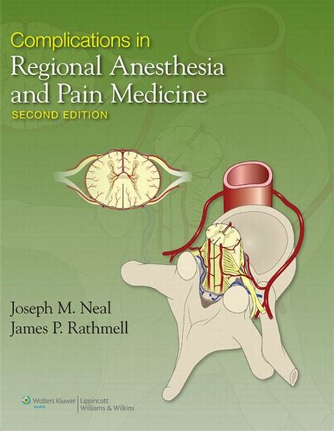 Complications in Regional Anesthesia and Pain Medicine 2nd Edition | CtsQena