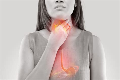 Progression and Possible Complications of Gastroesophageal Reflux Disease (GERD) | PainScale