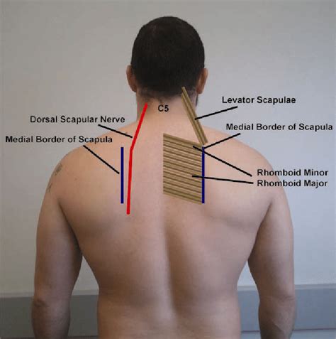 Pathway of the dorsal scapular nerve | Download Scientific Diagram