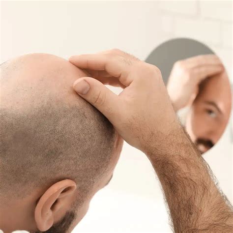 Bald Head Care for Men - The Modest Man