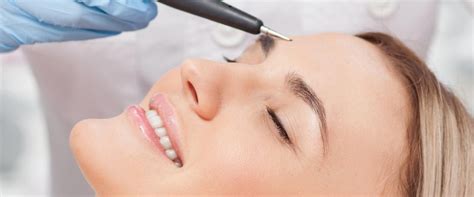 Electrolysis Hair Removal - The Vault, Wye, Ashford Kent