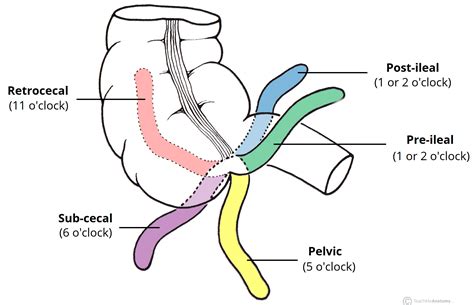 The Appendix - Retrocecal - Arterial supply - Appendicitis - TeachMeAnatomy