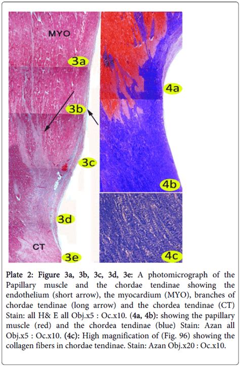 cytology-histology-a-photomicrograph-chordae-tendinae