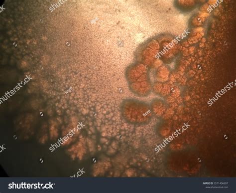 Bacterial Colonies Under Microscope Stock Photo 1571406607 | Shutterstock