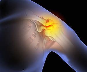 Shoulder Impingement Treatment Durham NC | Morrisville Impingement Syndrome