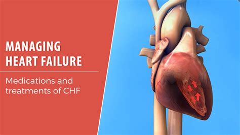 How Heart Failure Causes Fluid Build Up - vrogue.co