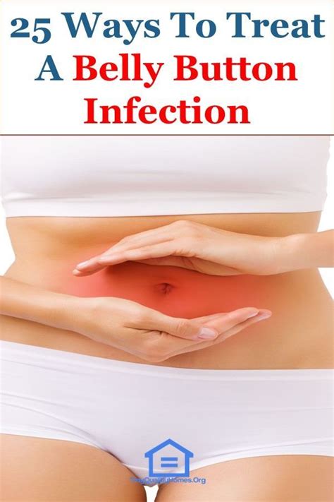 How To Treat A Belly Button Infection – 25 Natural Remedies: This ...