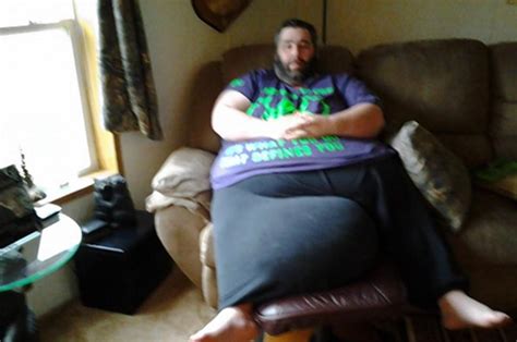 Man with 100-pound scrotum prepares for surgery - NY Daily News