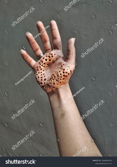 Fake Holes Hand Latex Wounds Stock Photo 2284426255 | Shutterstock