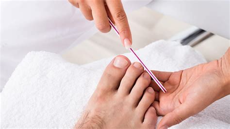 How to Treat And Prevent Dead Toenail - Fashionably Male