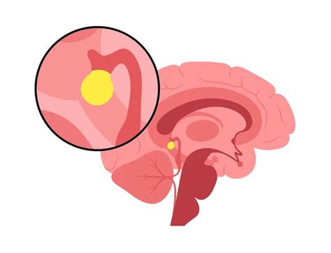 Vector illustration of human brain anatomy Stock Vector by ©Pikovit 300854050
