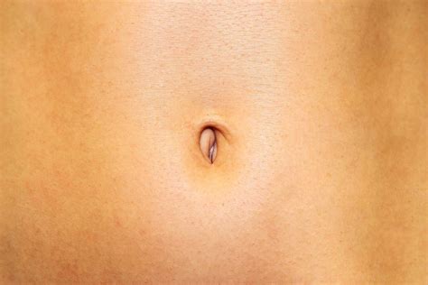 Belly Button Discharge – Causes, Yeast, Smelly White, Brown, Yellow & Bloody Discharge ...