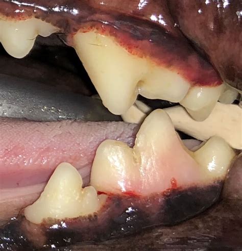 Tooth Resorption