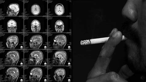 Here's How Nicotine Impacts The Brain | 6 Minute Read