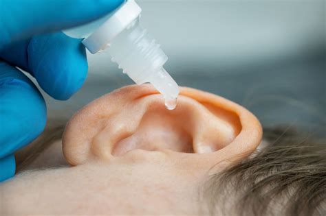 Is it safe to put hydrogen peroxide in your ear? | Miracle-ear