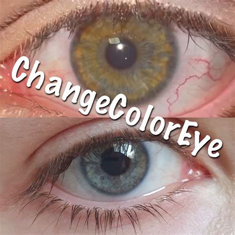 eye color change permanent,permanent eye color change,eye color before ...