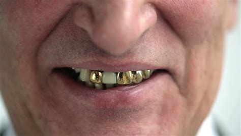 Smiling Old Man With Gold Teeth Stock Footage Video 8498572 - Shutterstock