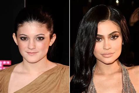 Å! 27+ Grunner til Kylie Jenner Before: Her face shape is slightly different now than it was ...