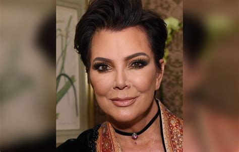 Kris Jenner's Plastic Surgery Makeover Exposed By Top Docs