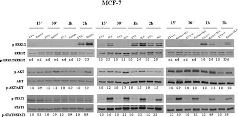 RANTES and IL-6 cooperate in inducing a more aggressive phenotype in ...