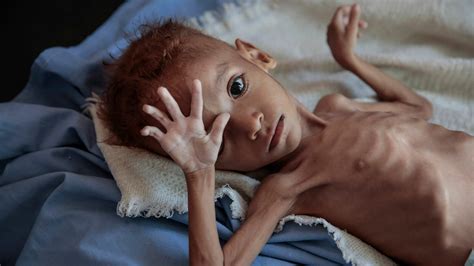 Nicholas Kristof: Starving children don't cry