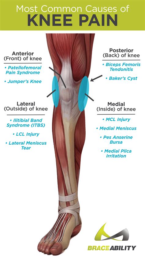 Types of knee pain anterior posterior medial lateral knee pain – Artofit