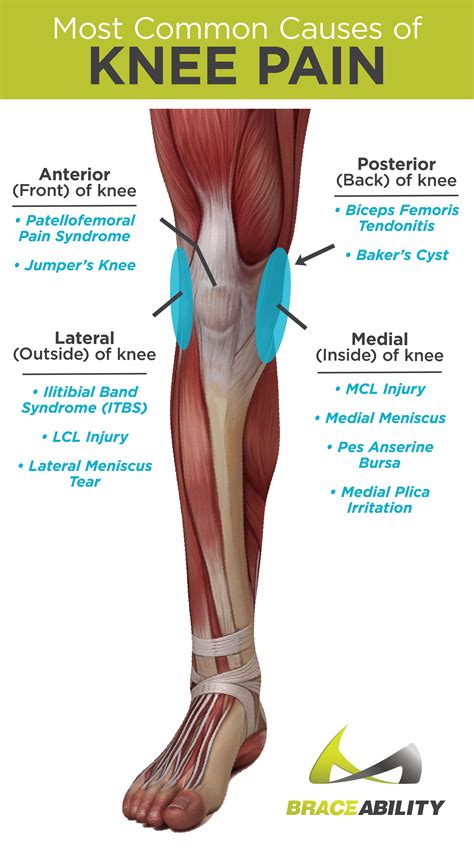 Pin on Knee Injuries | Why Does my Knee Hurt? Common Problems that ...