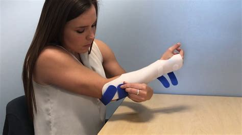 Muenster Orthosis - YouTube