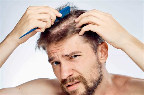 4 Common Causes of Hair Loss in Men - Live Enhanced
