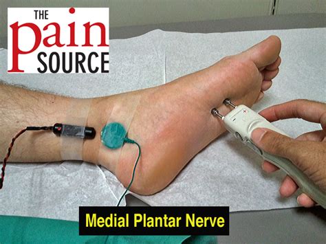 Nerve conduction tests painful | doctorvisit