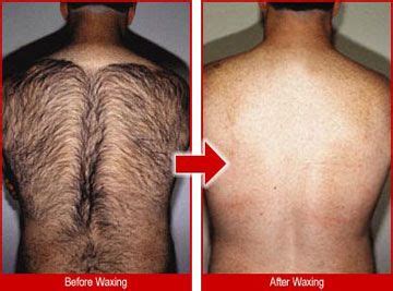 A man hairy back before and after waxing. | Beard tattoo, Hairy, Waxing