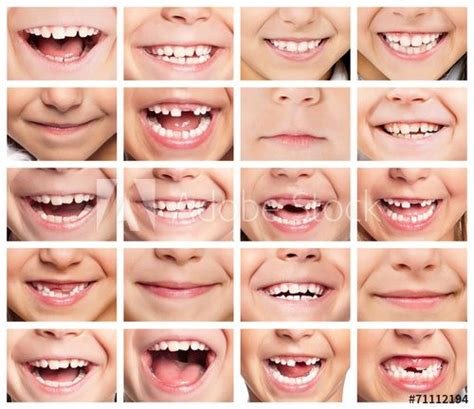 Set of smiles in 2021 | Dental images, Healthy teeth, Dental facts