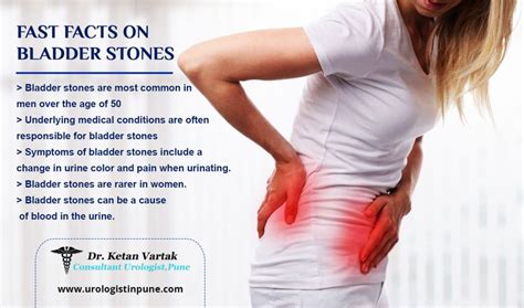 What is Bladder Stone and It's Symptoms? - Dr. Ketan Vartak