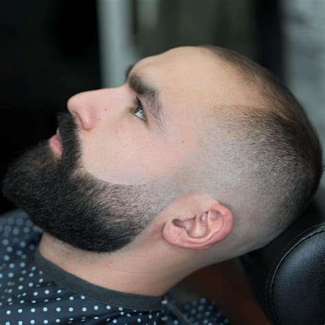 Male Pattern Baldness Hairstyles